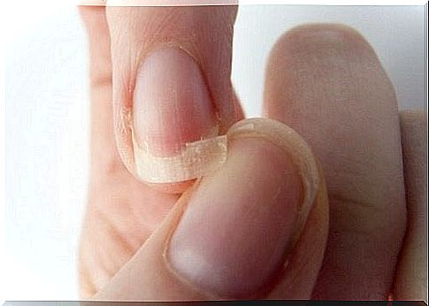 Chewing finger nails