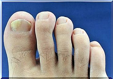 Flip flops and skin diseases