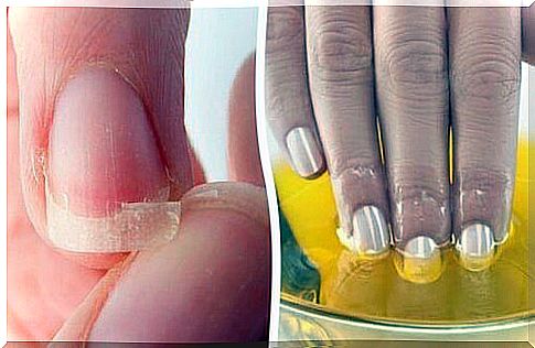 Brittle nails?  Try these natural remedies!
