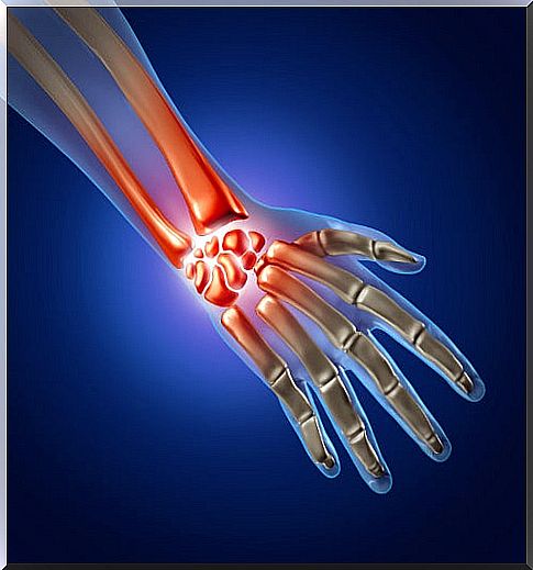 Carpal tunnel syndrome