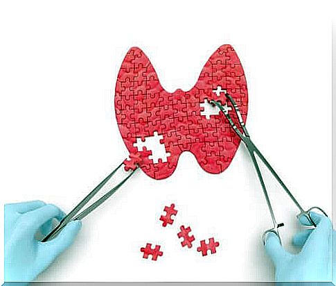 Hidden signs of an underactive thyroid