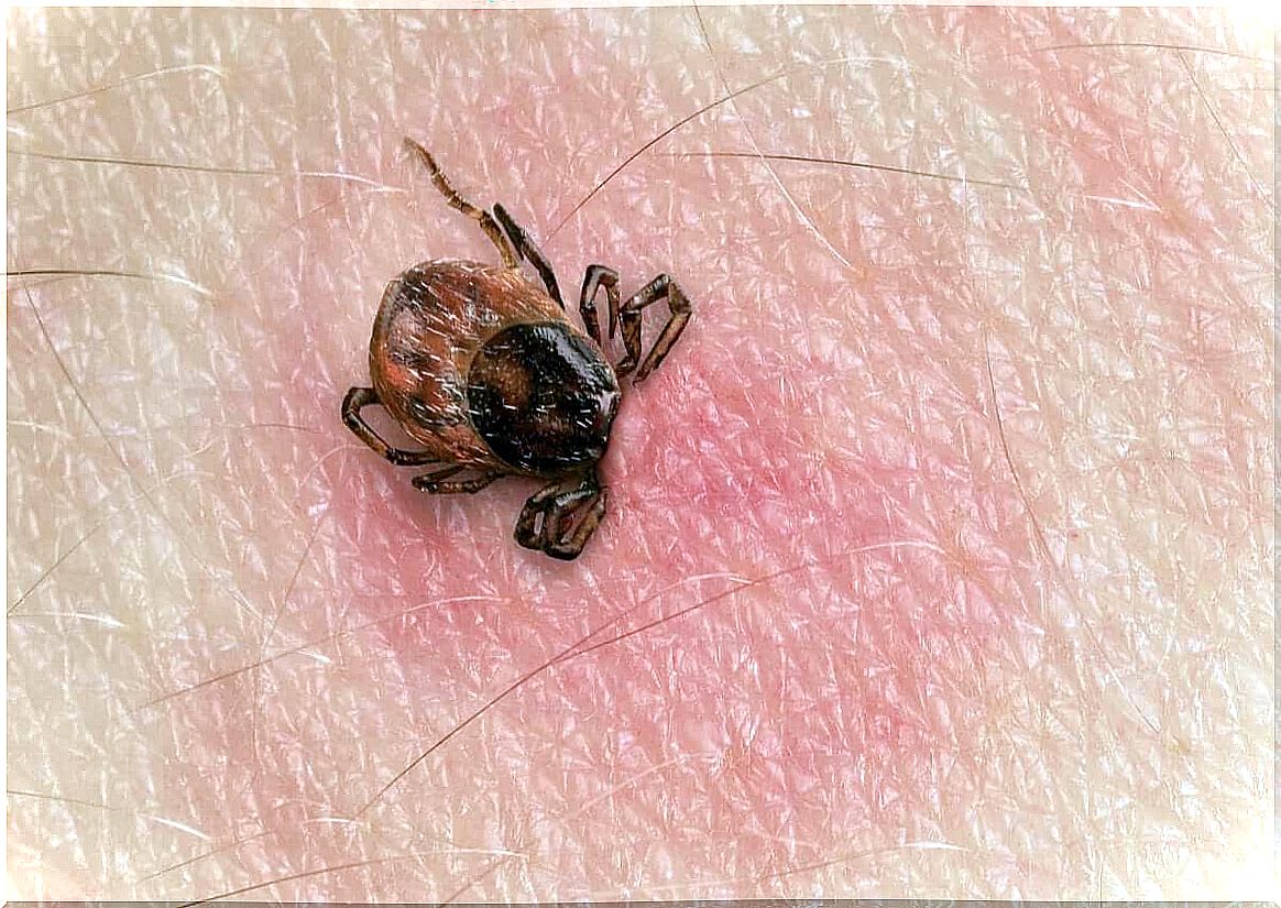 Lyme disease caused by ticks