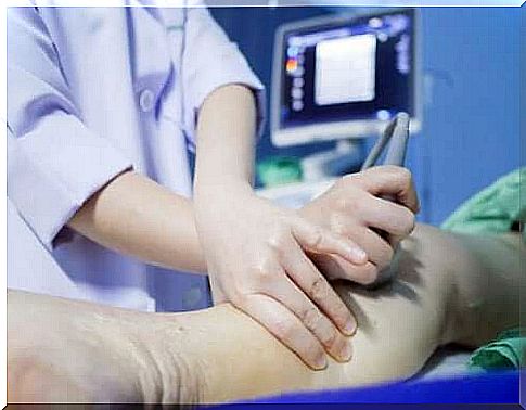 How to recognize deep vein thrombosis