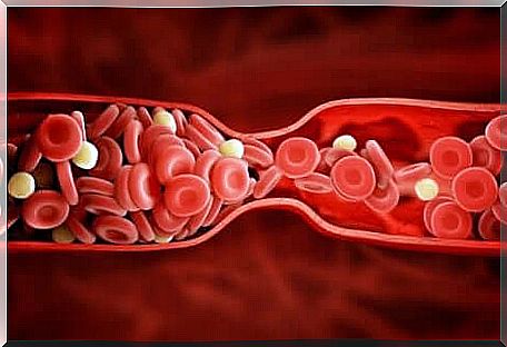 Side effects of treatment with atorvastatin 