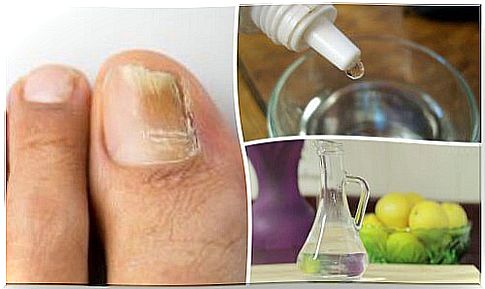 Make home remedies for nail fungus yourself