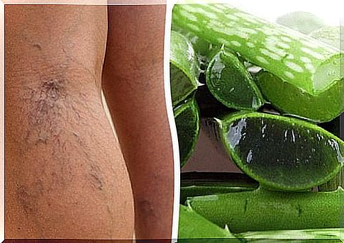 Supplement the therapy of your varicose veins with aloe vera