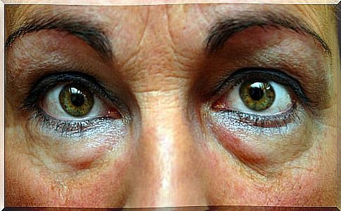 Treat swelling under the eyes