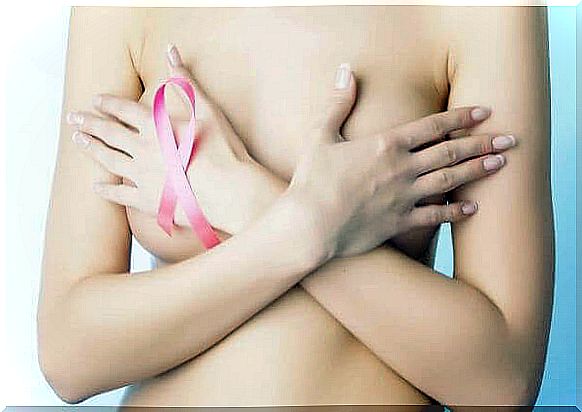 Breast cancer sagging breast