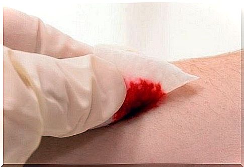 gelatine-for-faster-wound-healing